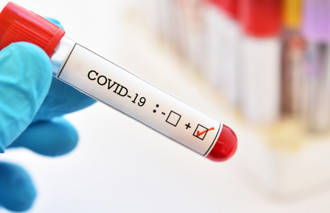 У Польщі не пустили автобус з України через хворого на COVID-19 пасажира