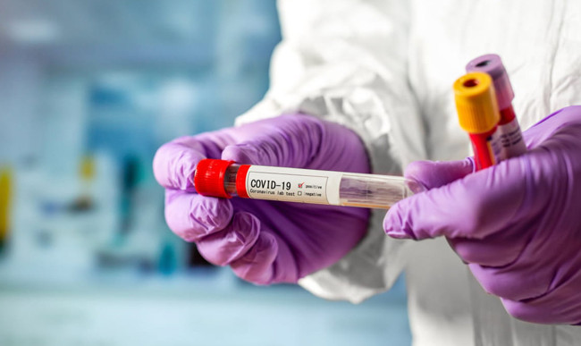 Повідомлення про важкі побічні ефекти після вакцинації від COVID-19 — фейкові: МОЗ