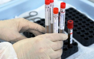 В Украине 6 377 новых случаев коронавируса