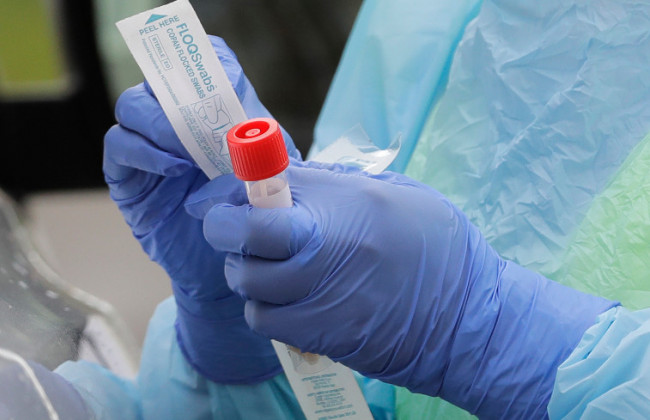 Вероятность умереть от «британского» штамма COVID на 64% выше, чем от других, — ученые