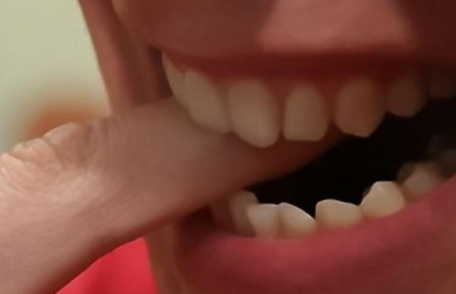 Откусил палец патрульному: в Одессе провели задержание буйного мужчины