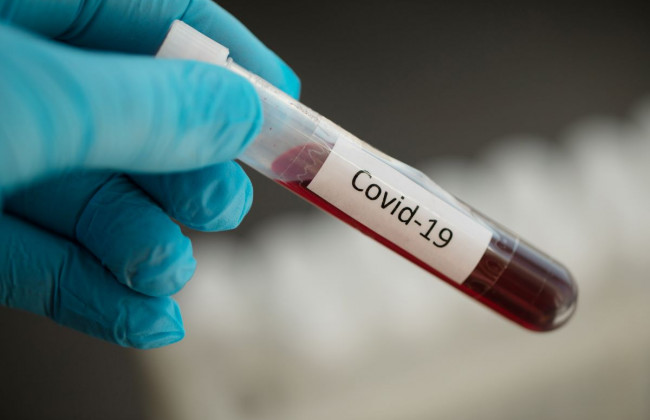 Ситуация с коронавирусом: 13 738 новых случаев за сутки