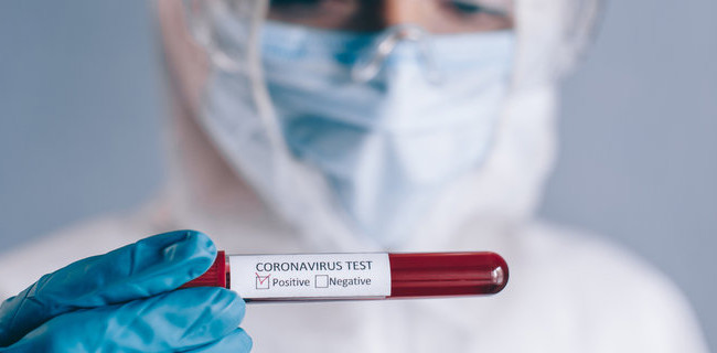 Украина остается первой в Европе по темпам распространения коронавируса