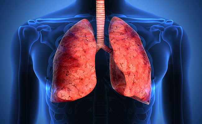 Фиброз легких после пневмонии COVID-19 может давать вторую волну поздней смертности: исследование