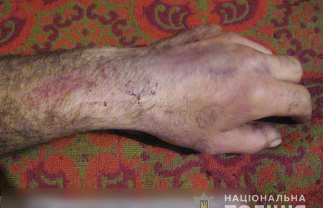 Вбив батька під час сварки: зловмисника затримано