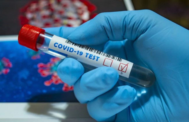 В Украине больше 17 тысяч новых случаев COVID-19