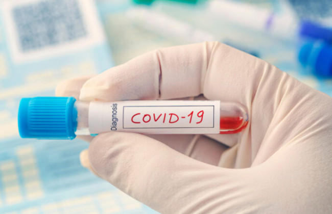 Понад 6500 нових випадків: стало відомо про ситуацію з COVID-19 станом на 19 квітня