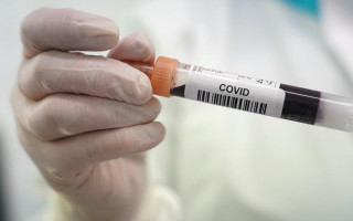 COVID-статистика: в Украине 12 711 новых случаев за сутки