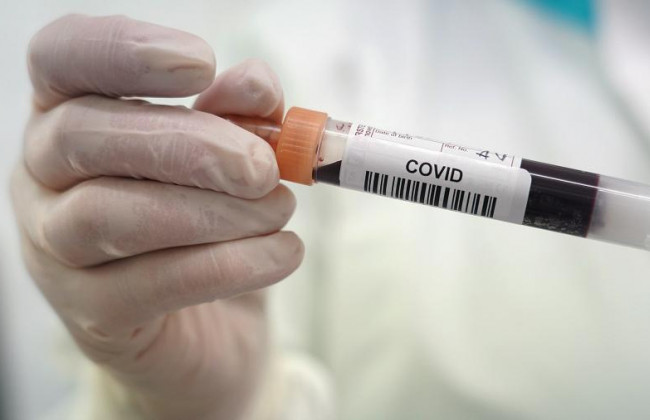 COVID-статистика: в Украине 12 711 новых случаев за сутки