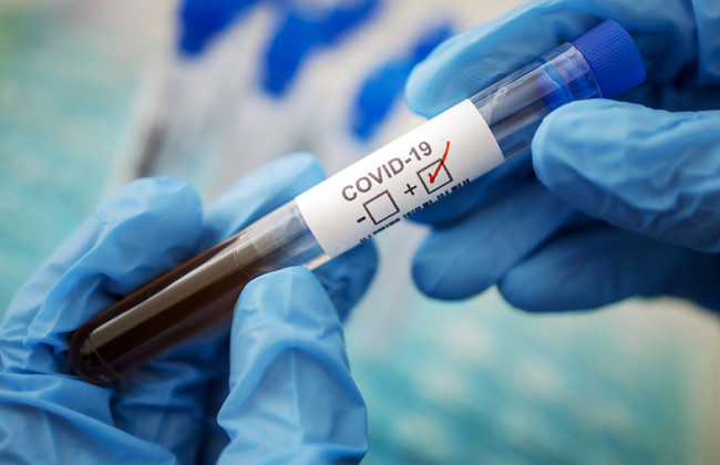 COVID-статистика: в Украине почти 8 тысяч новых случаев