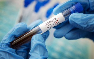 COVID-статистика: в Украине почти 8 тысяч новых случаев