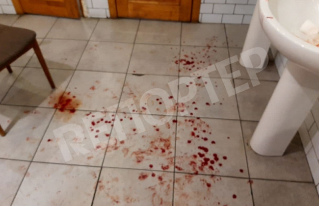 Поножовщина в днепровском кафе: пострадал парень, фото