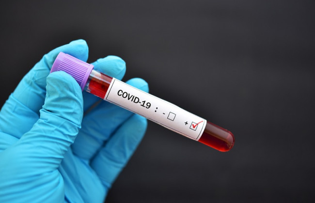 Спад COVID-случаев: в Украине за прошедшие сутки заболели 2576 человек