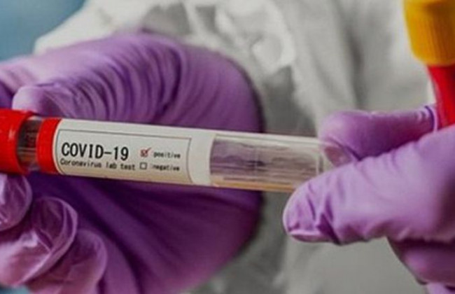 Україна отримала півмільйона доз вакцини CoronaVac