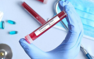 Ситуация с COVID-19: число новых случаев сократилось