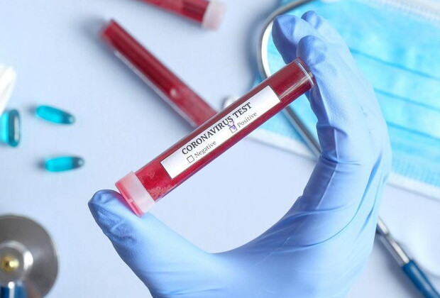 Ситуация с COVID-19: число новых случаев сократилось