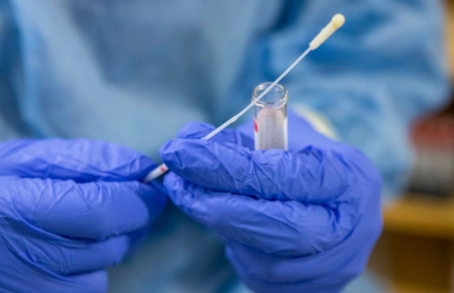 Финские ученые разработали новый экспресс-тест на COVID-19, способен выявить вирус за 10 минут