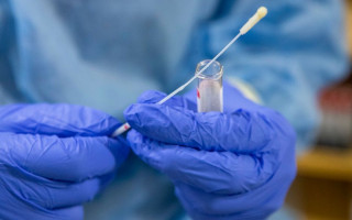 Финские ученые разработали новый экспресс-тест на COVID-19, способен выявить вирус за 10 минут