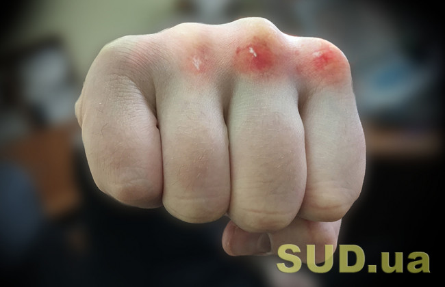 В ночном клубе Одессы произошла массовая драка: видео