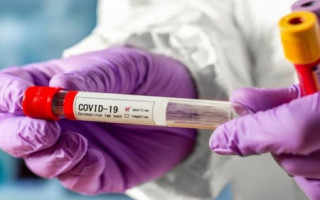 Ситуация с коронавирусом: за сутки 4 606 новых случаев