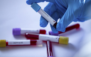 Українцям пояснили, чи потрібна вакцина тим, хто вже хворів на COVID