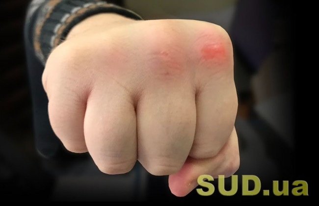 В Киеве агрессивный водитель «атаковал» Mercedes девушки, видео