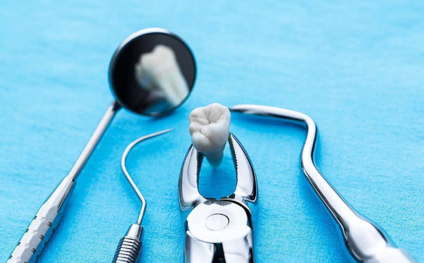 Под Киевом стоматолог удалил ребенку 12 зубов без согласия родителей, видео