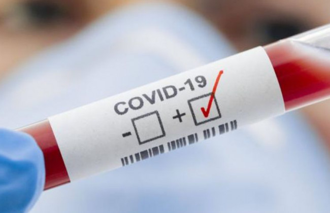 Медики предупредили о появлении «олимпийского» штамма COVID-19