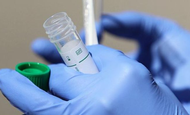 Срабатывает при любом штамме: нашли универсальное антитело к COVID-19