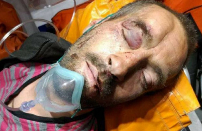 В Киеве разыскивают родственников мужчины, которого нашли избитым: фото