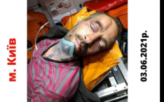 В Киеве мужчину избили и оставили умирать: ищут родственников