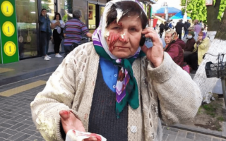 Борьба с конкурентами: под Ровно владелица салона разбила голову пенсионерке банкой сметаны, фото