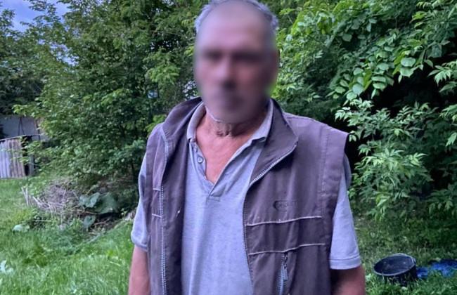 На Київщині чоловік у ході сварки підпалив дружину