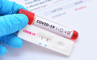COVID-статистика: в Украине 1603 новых случая