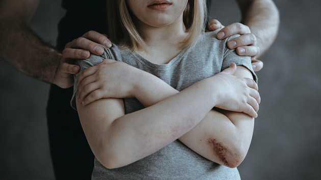 На Волыни 13-летняя девочка родила ребенка от 63-летнего отчима-насильника