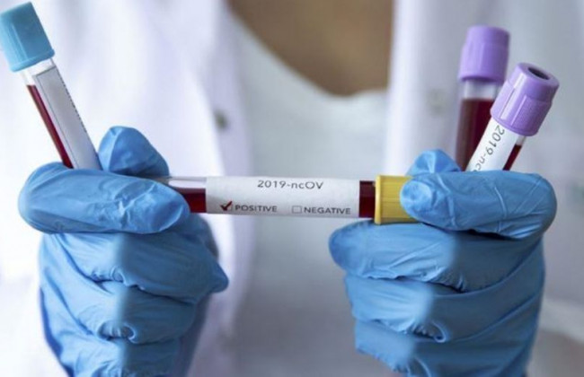 Индийский штамм Covid-19 быстро распространяется по миру: под ударом десятки стран