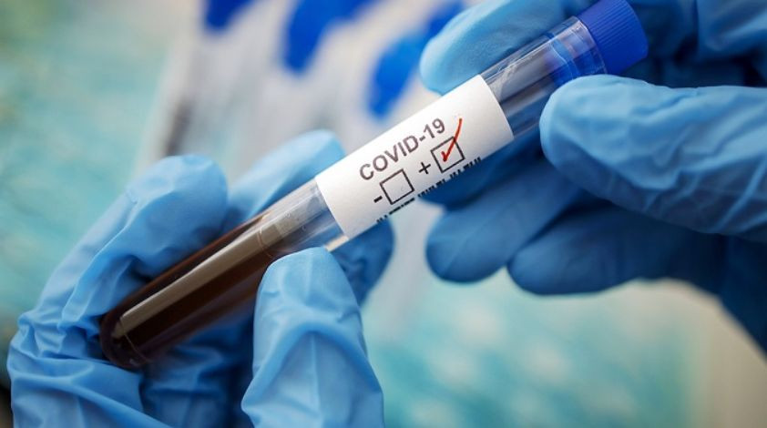 Дельта-штамм коронавируса оказался на 60% активнее альфа-варианта