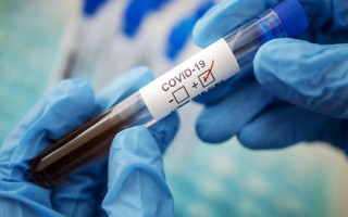 Дельта-штамм коронавируса оказался на 60% активнее альфа-варианта