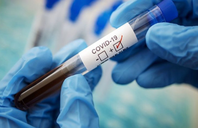 Дельта-штамм коронавируса оказался на 60% активнее альфа-варианта