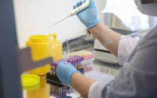 Ученые связали потерю обоняния при COVID-19 с разрушением мозга