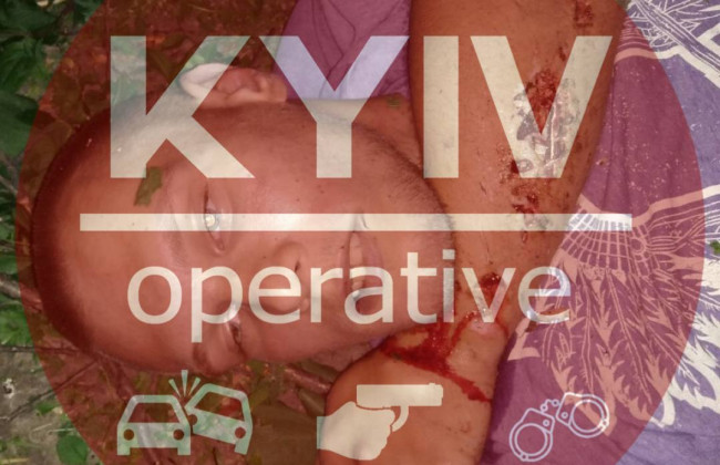 У Києві хлопець випав з 14 поверху