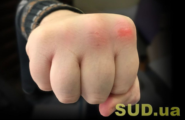 Киевляне устроили массовое побоище возле ночного клуба, видео