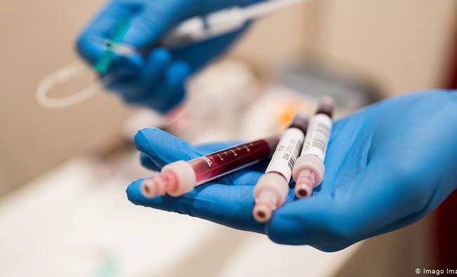 Лікар розповів, у кого може не виникнути антитіл до коронавірусу