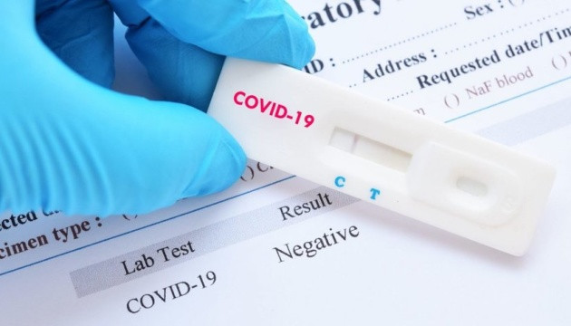 В Украине анонсировали запуск производства тест-систем на коронавирус