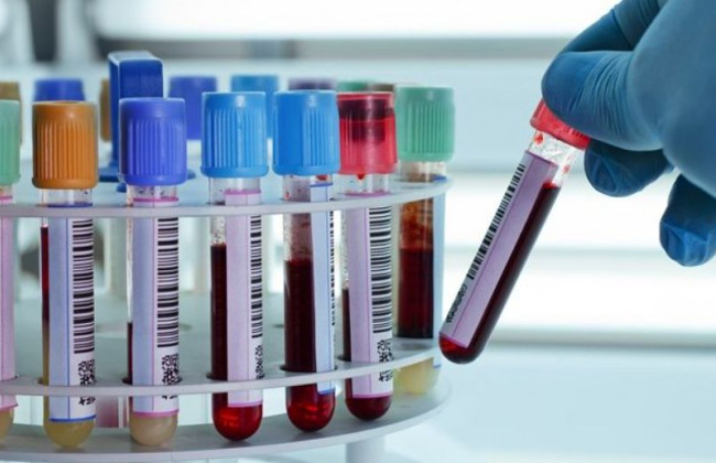 Назвали новый риск пандемии коронавируса для человека