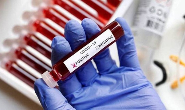 Ситуація з COVID-19 в Україні: за добу зафіксували 655 нових випадків