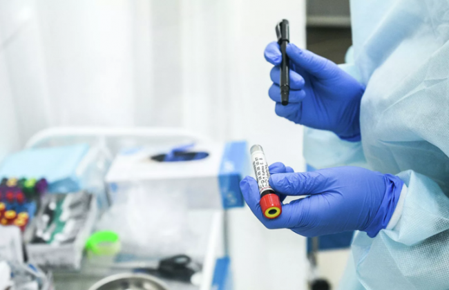 COVID-19 в Україні: за добу 507 нових випадків захворювання