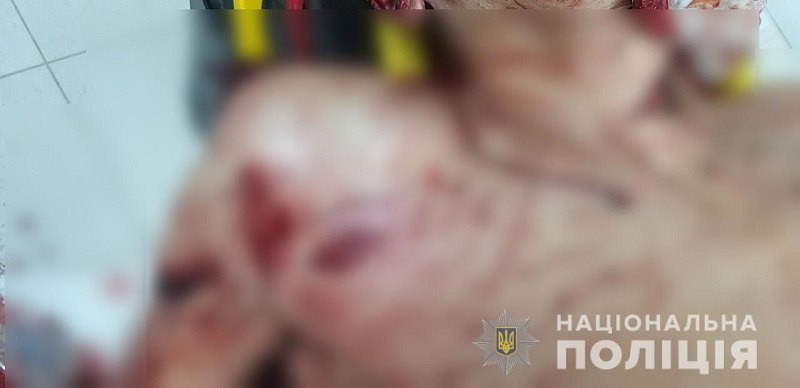 Трагедія на Київщині: лікар пошматував ножем перехожого
