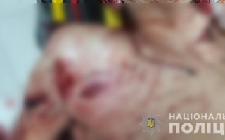 Трагедія на Київщині: лікар пошматував ножем перехожого