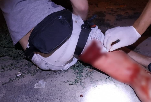 В Киеве неизвестный с ножом напал на парня: детали